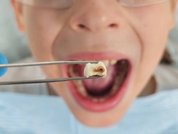 Best Mobile Emergency Dentist in Kemmerer, WY